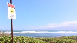 A "shark sighted" sign is posted at Waiehu Beach Park, where a shark bit a surfer Friday, November 1, on Maui.